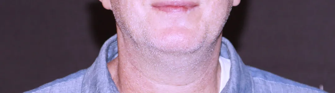 Michael Rapaport